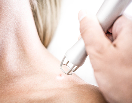 Lasermedizin